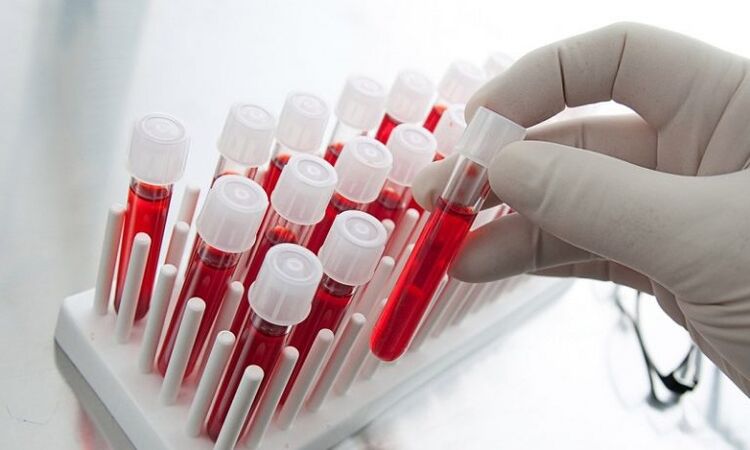 blood in test tubes for analysis of a dog with prostatitis