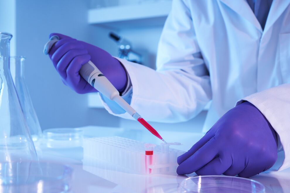 blood test to diagnose chronic bacterial prostatitis