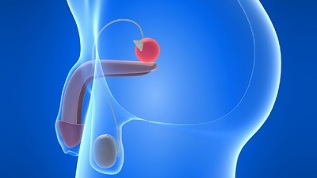 prostate massage to prevent prostatitis
