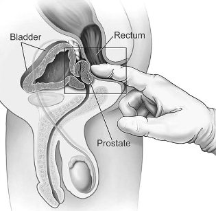 treatment of prostatitis in the house of massage