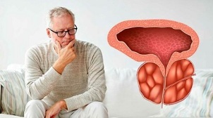 causes of bacterial prostatitis in men
